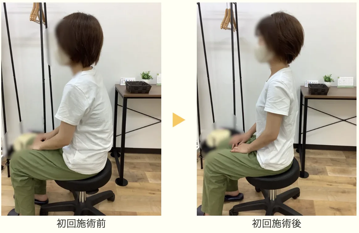 姿勢のビフォーアフター（座位）